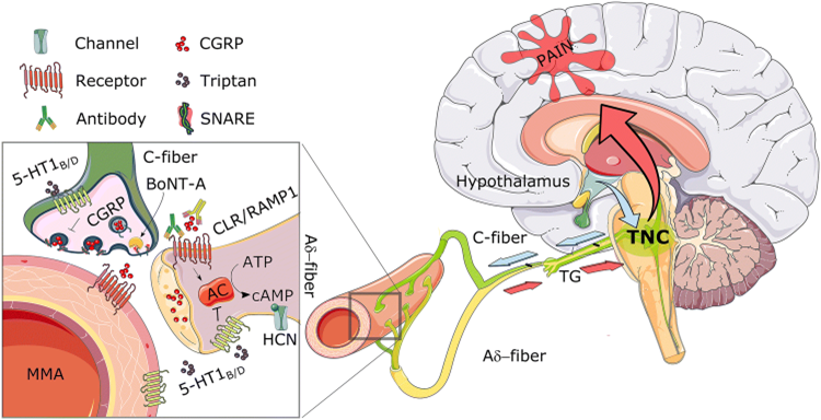 Migraines: A Quick Guide