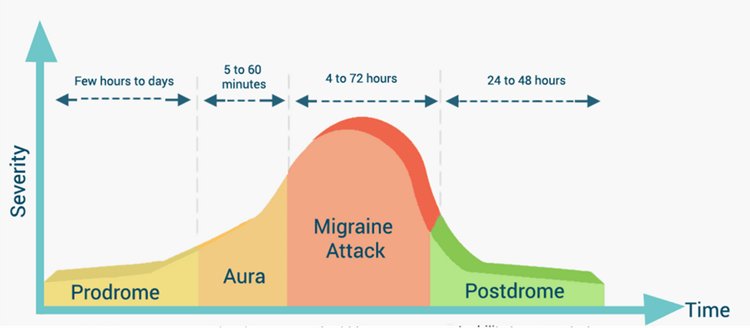 Migraines: A Quick Guide