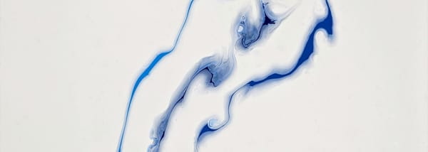 Hypervolemic Hyponatremia